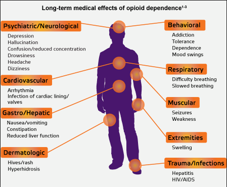 Oh snap - breaking off more than you can chew with opioids